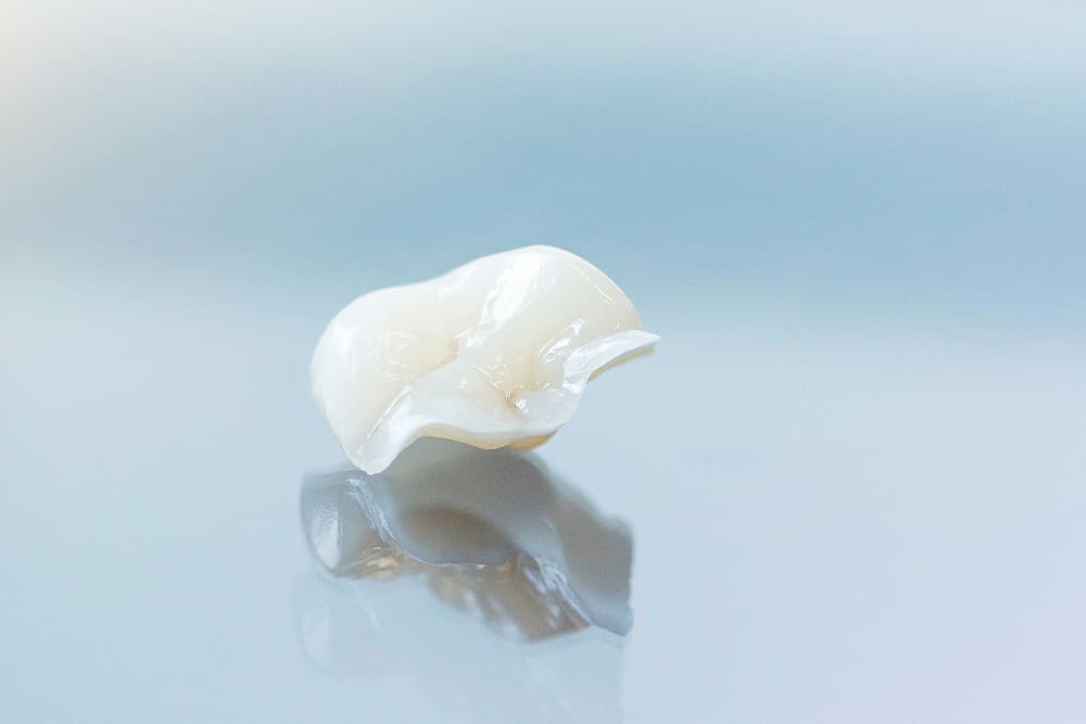 詰め物・被せ物の選択肢