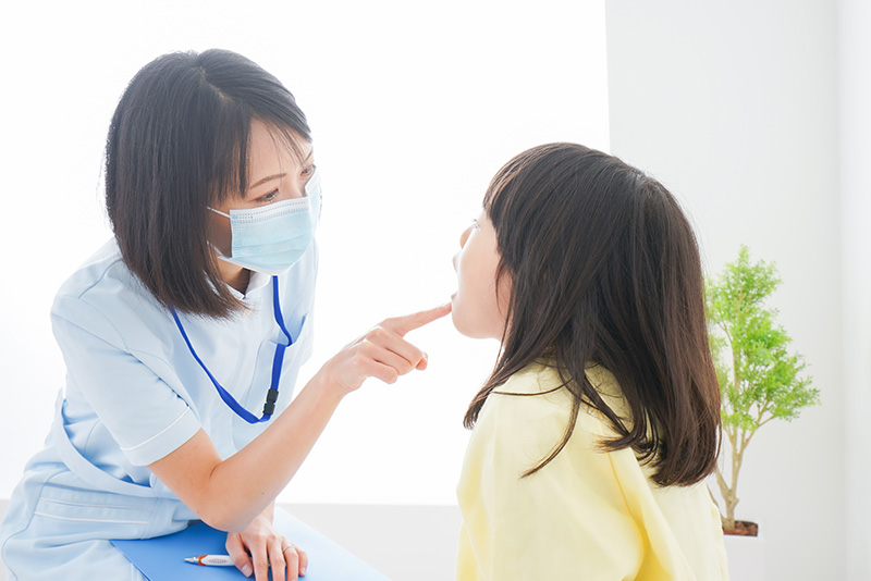 乳歯のむし歯治療