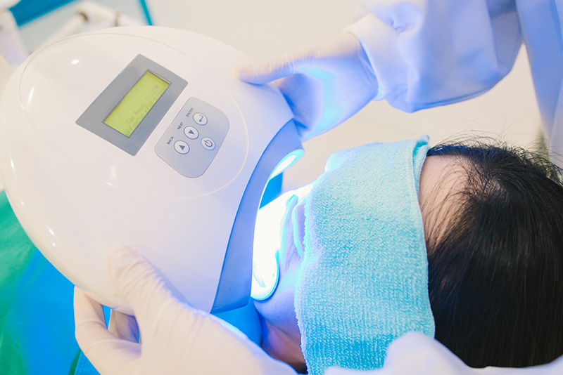 オフィスホワイトニングの処置場面