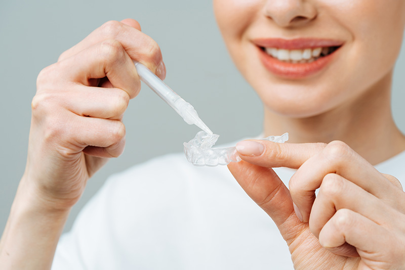 自宅でマウスピースを使ってホームホワイトニングをしている場面
